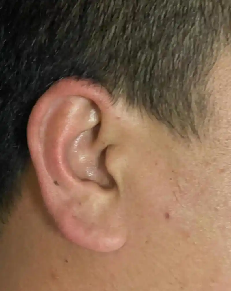 都说我老公和我儿子的耳朵有福气,曾经不觉为然,条件一般,不算穷,也不