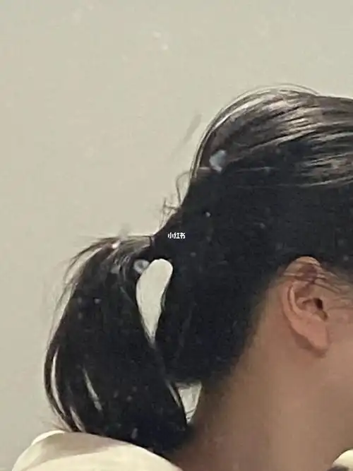 真的是,我妈到现在还说扁脑壳好看.我真的是服了!