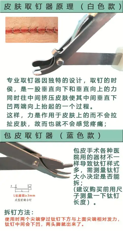 【jd健康】包皮钛钉取钉器 手术后拆钉器 吻合器 皮级缝合器 起钉器