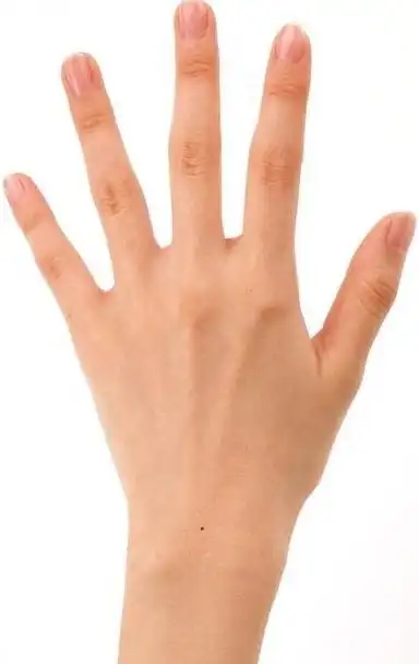 手腕背面中间有痣,如下图,代表什么