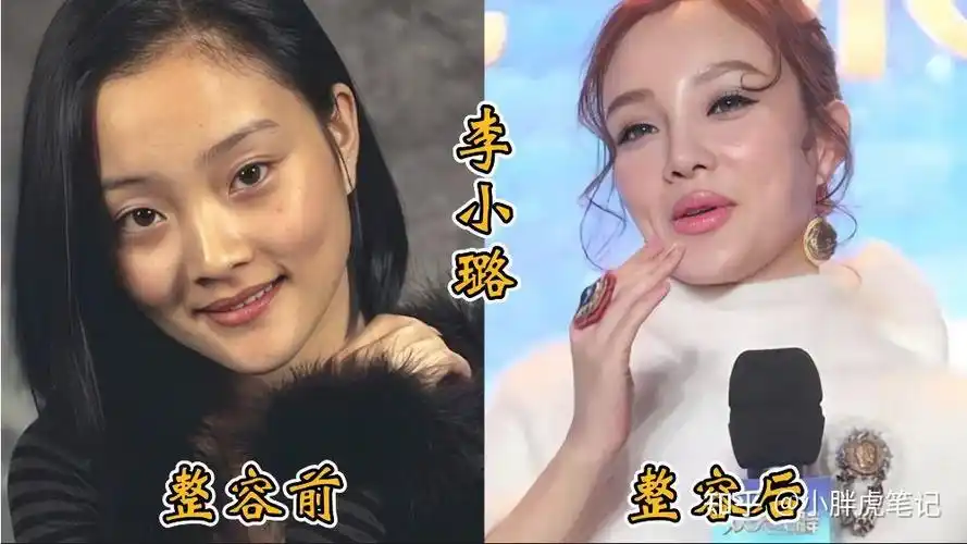 18位女明星整容前后对比邵音音面目全非杨颖堪称整容模板