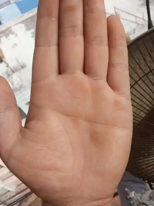 我是男的,双手都是断掌,到底是好是坏?