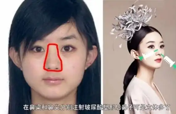 网曝赵丽颖整容前后对比照,疑似颖宝整容证据曝光