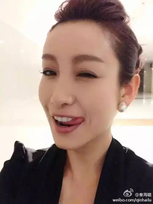 秦海璐割的双眼皮好大