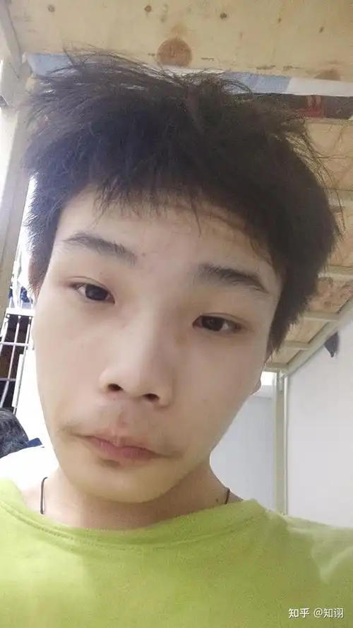 是天生的因为长相的原因从小学到高中一直很内向不自信还有一点社恐