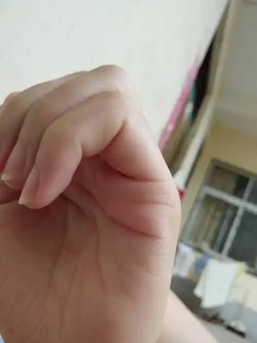 婚姻线右手有断开是怎么回事?