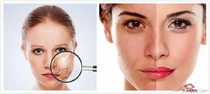改善脸部粗糙问题的几种方法