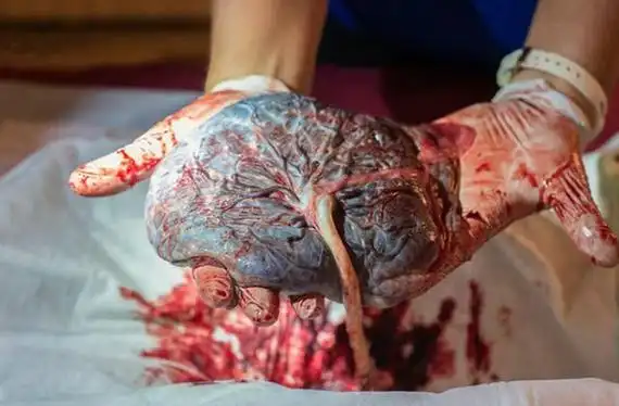 胎盘你见过吗看看这些美丽的照片