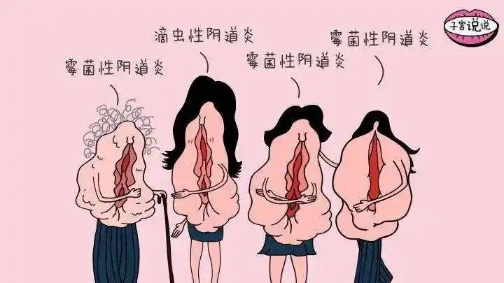 女人得妇科病,竟和男人有关系?医生认真脸:是的,需警惕-健康160