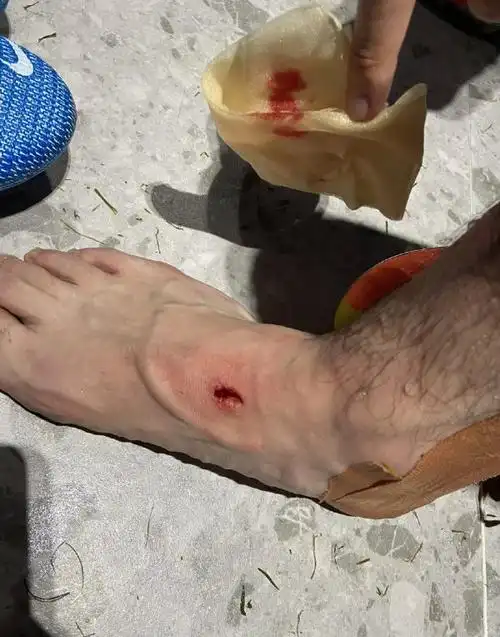 体坛联播中超赛场再现流血犯规巴萨新帅通知苏牙离队