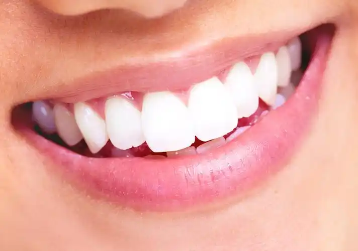 洁白牙齿牙齿医生黄皮肤白皮肤口腔医学