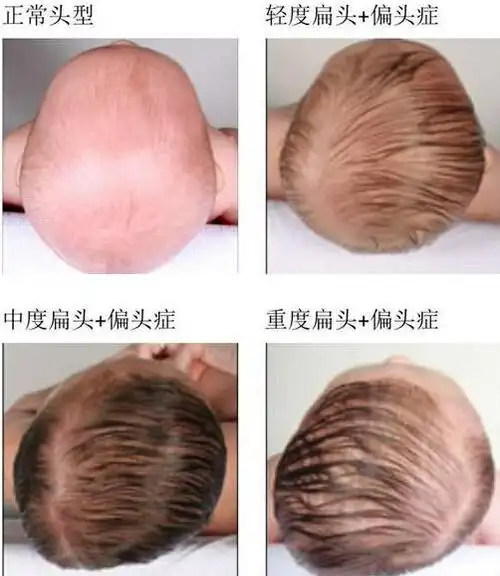 这样做真的能让我的宝宝变得更漂亮吗?