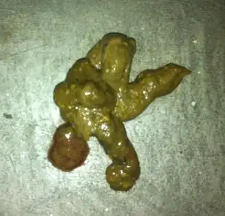 请高人指点萨摩便便,看病情!