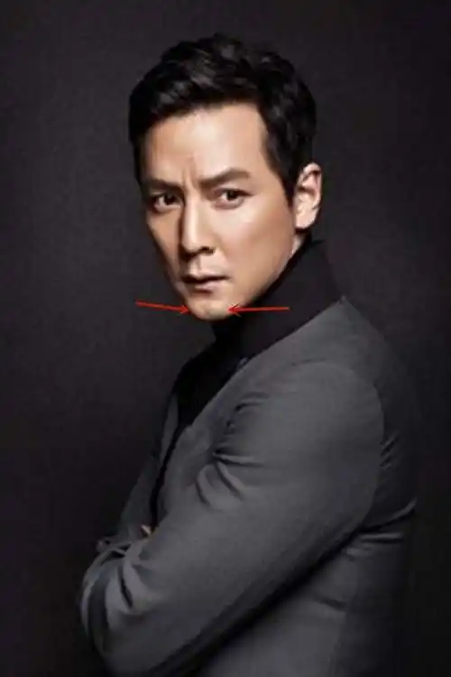 而男星里,苹果下巴最为出名的就是黄晓明