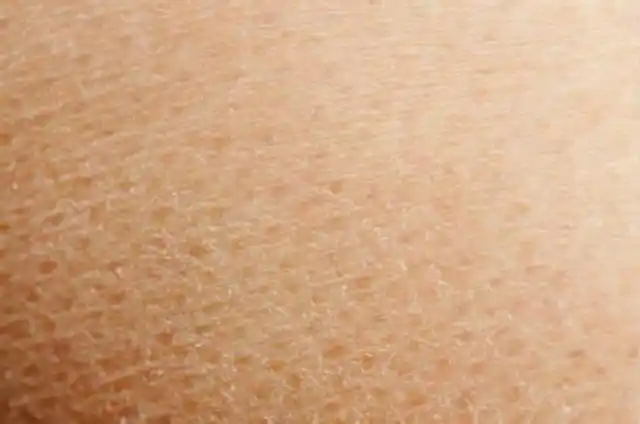 珍妮肤护肤小技巧:冬季脸部皮肤干燥脱皮怎么办?_珍妮肤(jenyf)官网