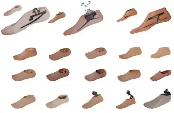 浅谈下肢假肢功能性部件---假脚与踝关节