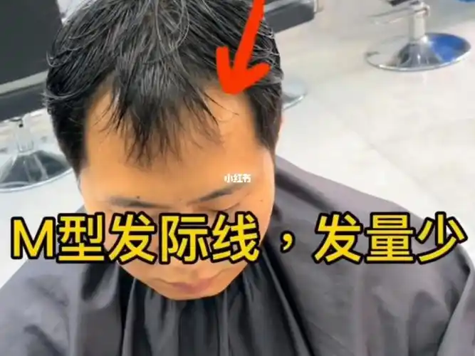 四款适合高额头m发际线男士发型