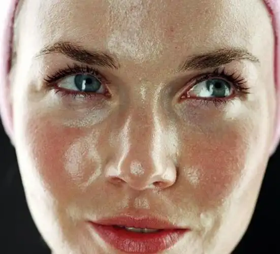 皮肤老爱出油这几个护肤知识要知道避免形成大油田