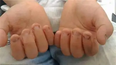 孩子啃手指,舔手指怎么办?