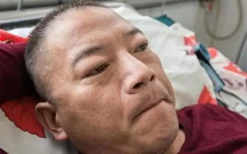 原创"尿毒症"到来时,头上会出现"3迹象",肾脏或已"受损"!