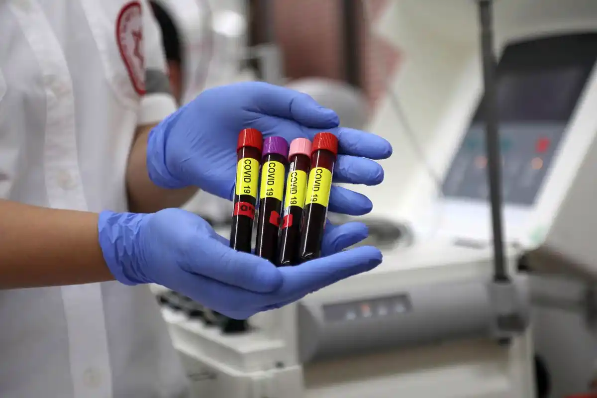 新研究新冠病毒感染风险可能与血型有关