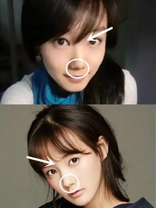 永远的女主李一桐整容史比后台还精彩