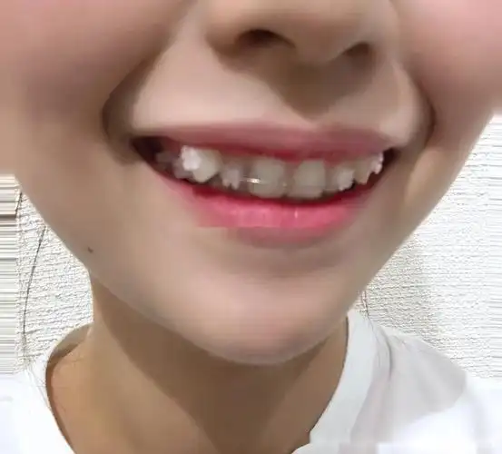 虎牙女孩的颜值如何从五分涨到七分?