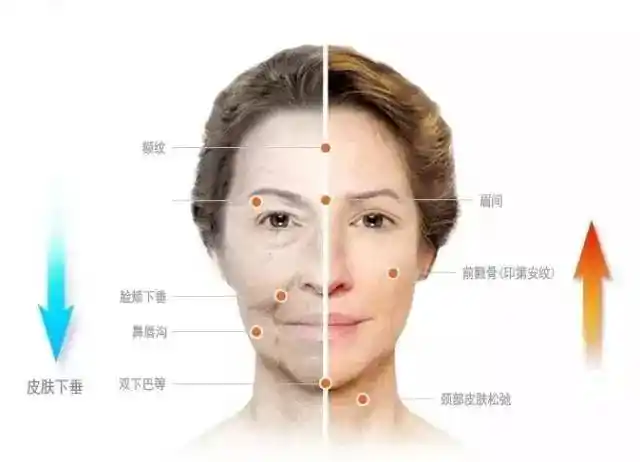 超声刀:和同龄一起拍照,可以差一个辈份是什么样的感觉!