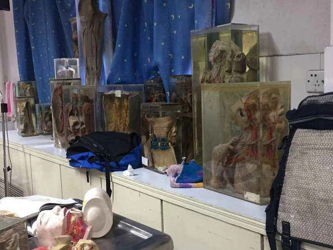 人体标本制作师每天在劳累惊恐度过一年处理50具捐献遗体