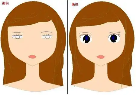 北京延世整形哪个医生做双眼皮好