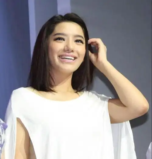 曾超女夺冠后"无人问津",如今却因整容失败爆火,现状让人心酸