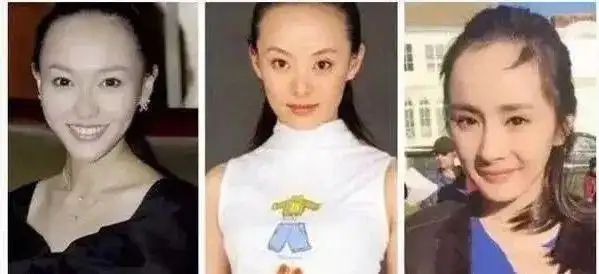 植树节快到了?杨幂,粉丝叫你去植发