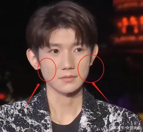 王源上央视节目,无美颜直播暴露真实颜值,这皮肤状态我没眼花?