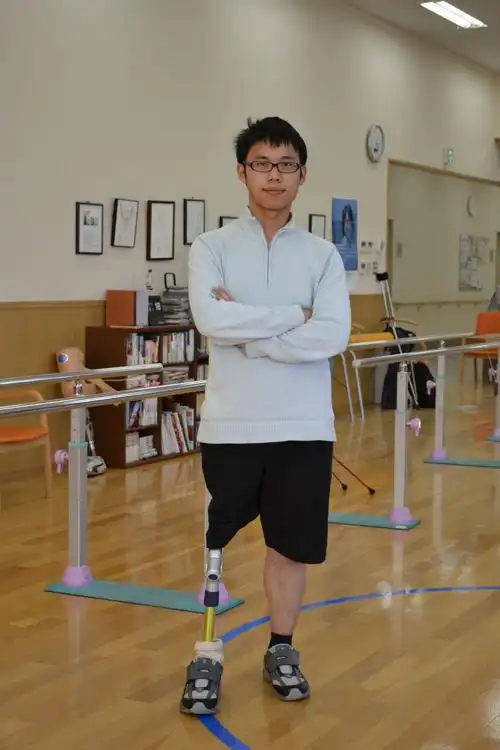 孙小军第一次安装上假肢.图片由受访者提供