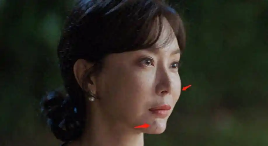 陈数面容大改变,整容后遗症居然是这样_董洁_周迅_自然