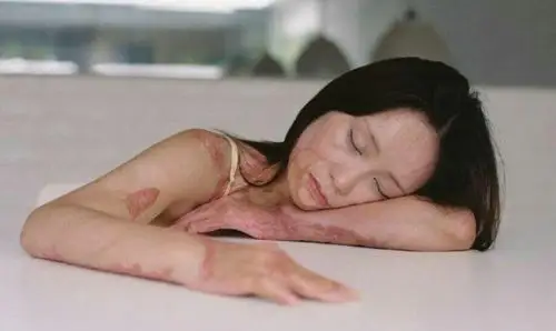 周岩请摘去她毁容的标签这样她会走得更好