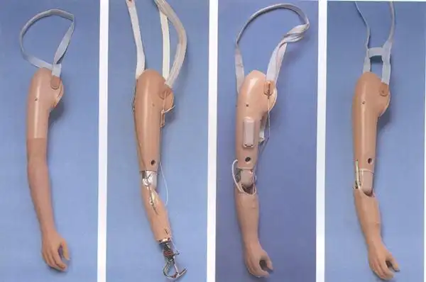 手指假肢可以让截肢患者重获自信心