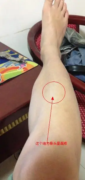 我老是腿疼,说不出来的那种疼,就是片骨里面酸酸的,和抽筋差不多,就是