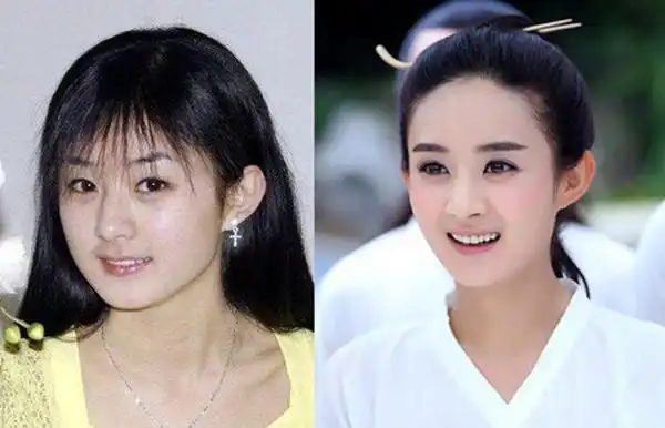 赵丽颖刚出道时还是个胖子,然后她就这样瘦了?