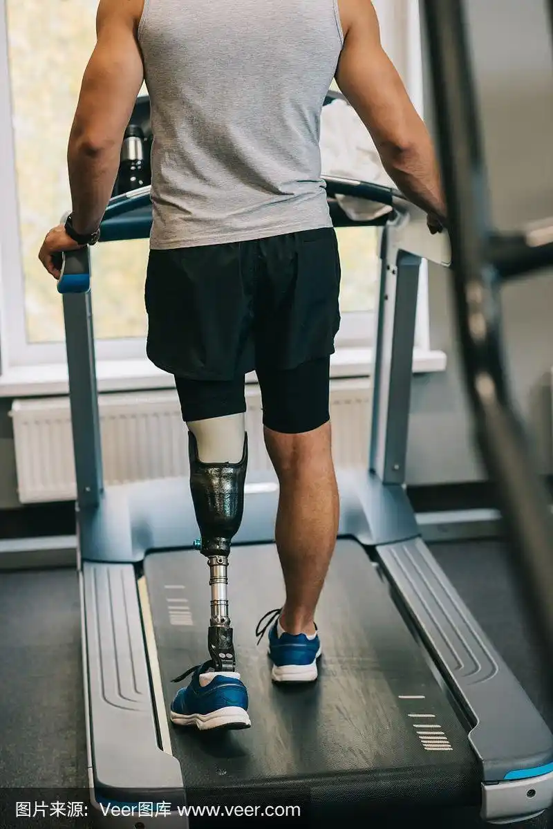 截短镜头的运动员与假肢行走在跑步机上在健身房