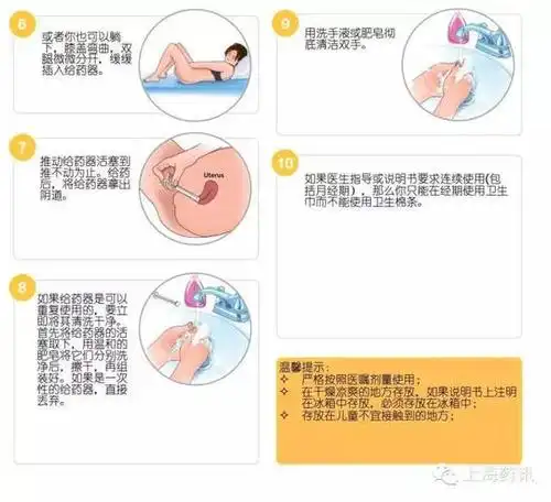 不懂腔道给药,这就很尴尬了