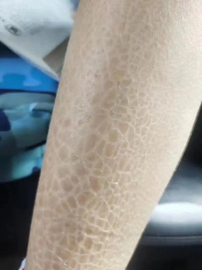 焕新重启,奔赴2023#皮肤 #皮肤干燥 - 抖音