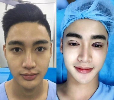 越南chukhahieu整容变帅哥一跃成为人气颇高的男网红
