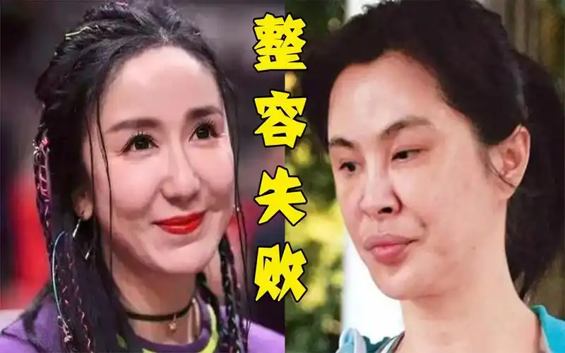 "整容失败"的女星,娄艺潇女神变女鬼,看到王祖贤:心碎了一地