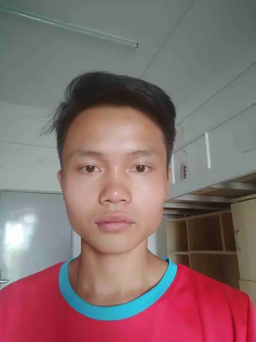 四方脸脸部凹凸不平脸又大又丑想改变一下