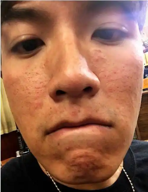 宋慧乔李秉宪被原谅他却被驱逐出境韩国劣迹艺人如何翻身