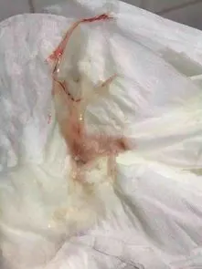 白带有一点点血丝图片 - 搜狗图片搜索