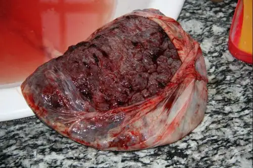 吃胎盘真的可以大补吗?