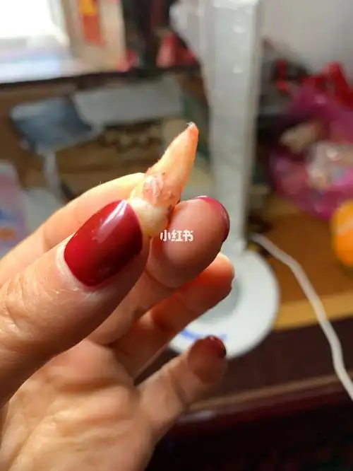 座牙怎么虎牙拔下来的图片拔虎牙拔出的牙齿图片拔小虎牙的脚图文的