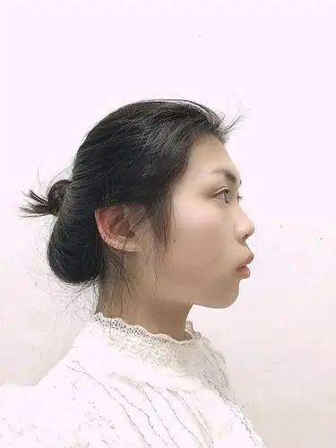 从侧面看整个轮廓都是凸出来的,真的好丑,嘴都是凸起_圈子-新氧美容